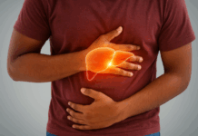 Fígado gorduroso: esteatose hepática já afeta 38% da população mundial